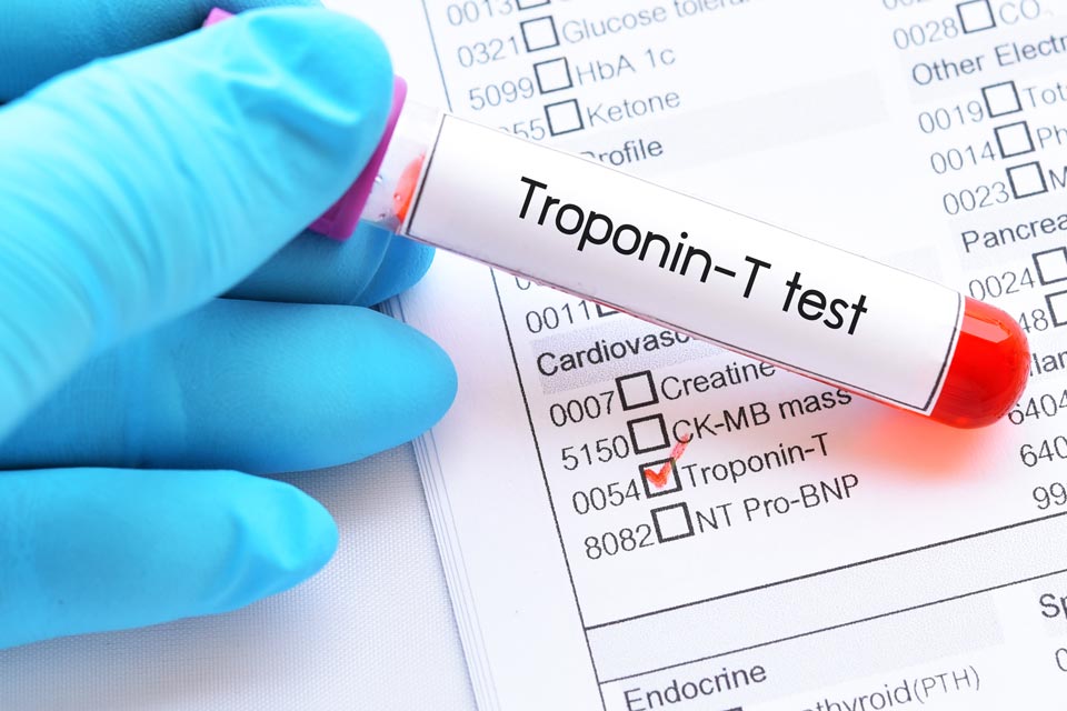 Biotin is known to interfere with certain lab tests, including a dangerous interference with tests for troponin.